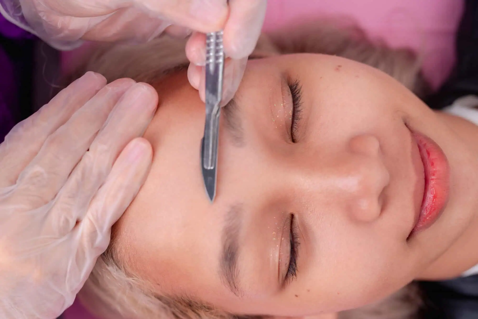 Dermaplaning in Corpus Christi, TX