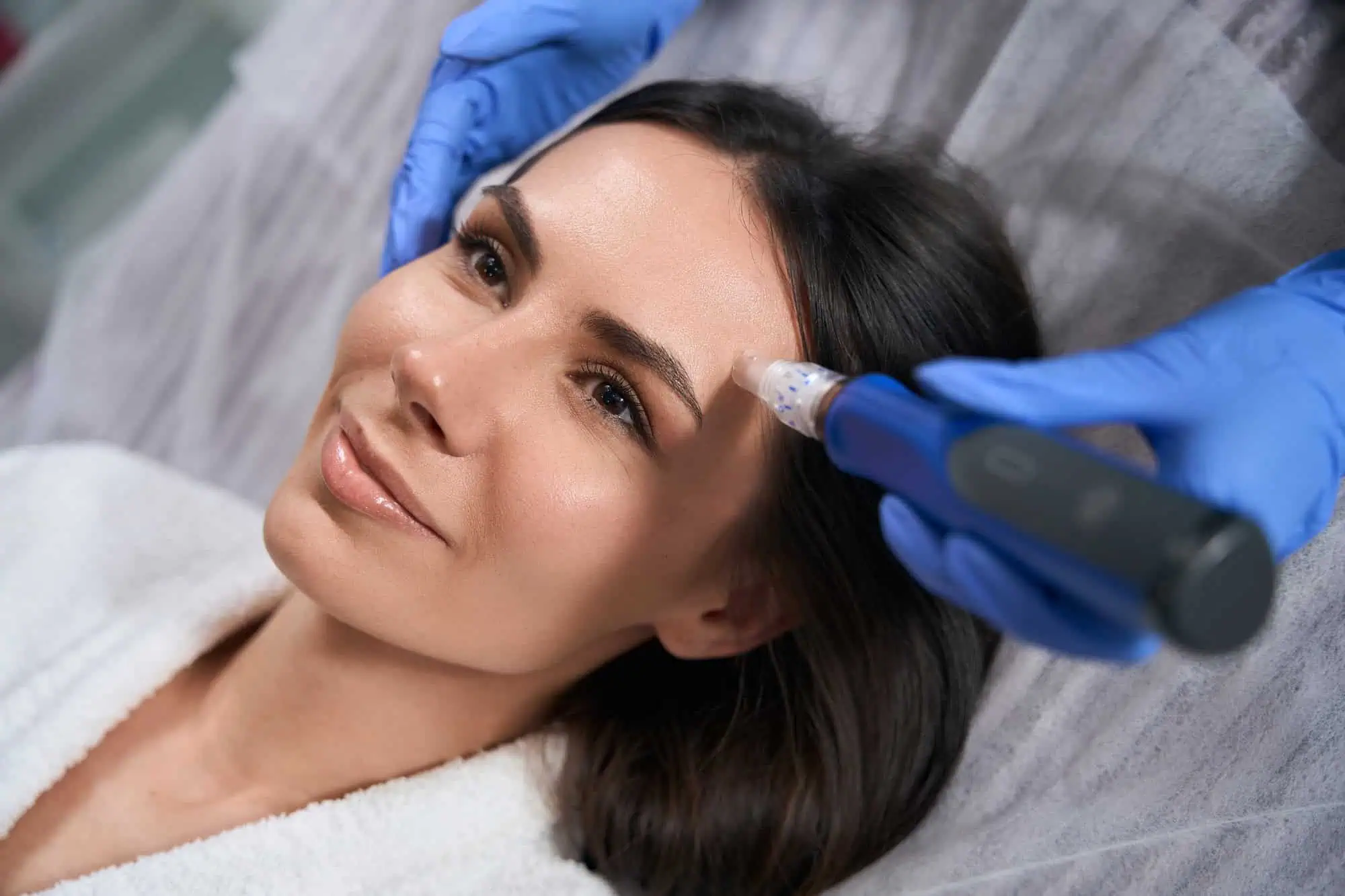Microneedling in Corpus Christi, TX