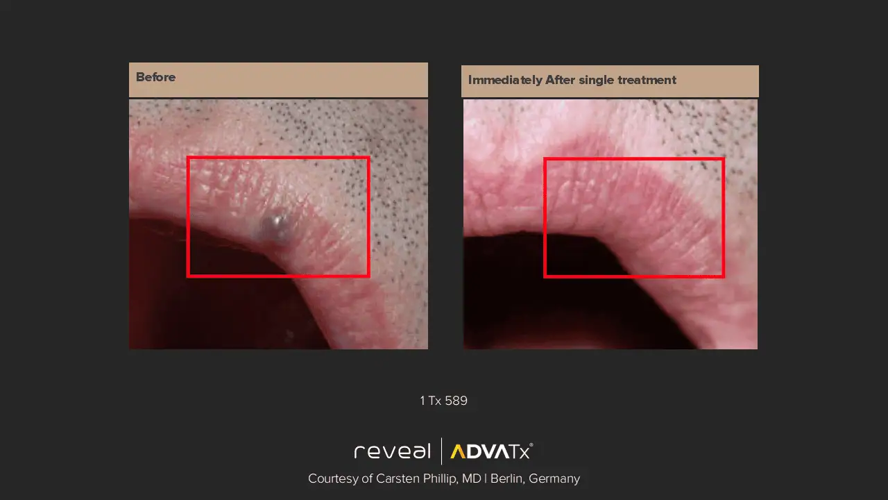 ADVATx | Corpus Christi, TX | Coastal Glo Med Spa