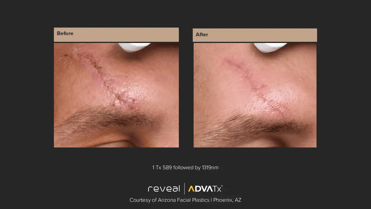 ADVATx | Corpus Christi, TX | Coastal Glo Med Spa