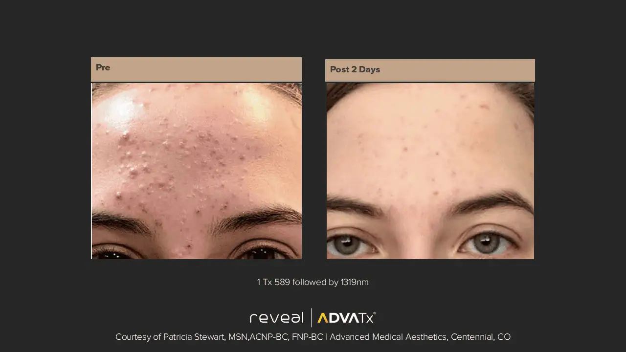 ADVATx | Corpus Christi, TX | Coastal Glo Med Spa