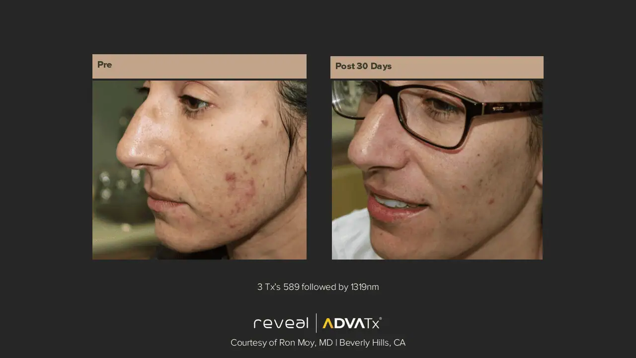 ADVATx | Corpus Christi, TX | Coastal Glo Med Spa